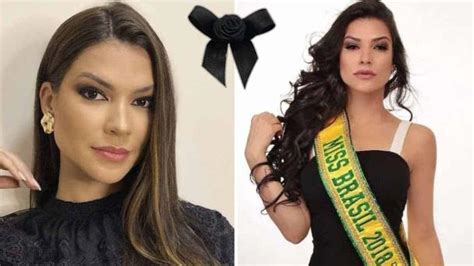Diario Del Yaqui Miss Brasil Muere Tras Cirug A Para Extirpar Las Anginas