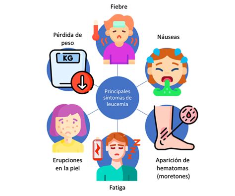 Principales Síntomas De La Leucemia Download Scientific Diagram