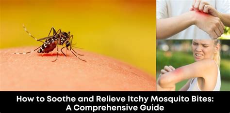 How To Soothe And Relieve Itchy Mosquito Bites A Comprehensive Guide Hands Magazine Kenya