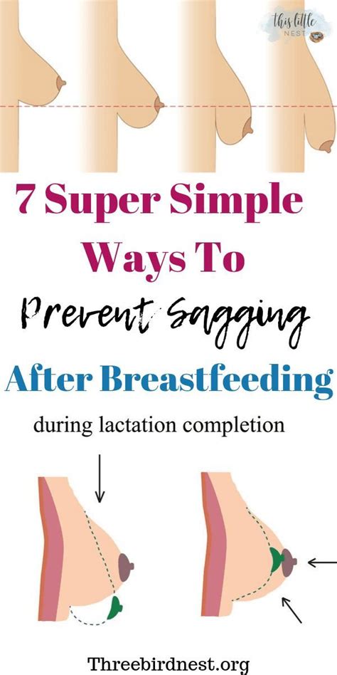 7 Things You Can Do To Prevent Sagging Breasts After Breastfeeding