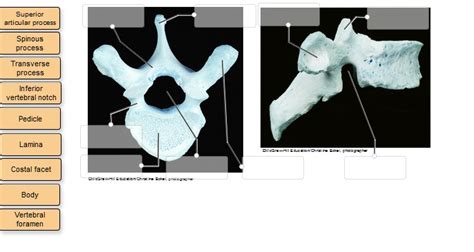 SOLVED Label The Bone Features Bone Markings Of The Thoracic Vertebrae In Superior And
