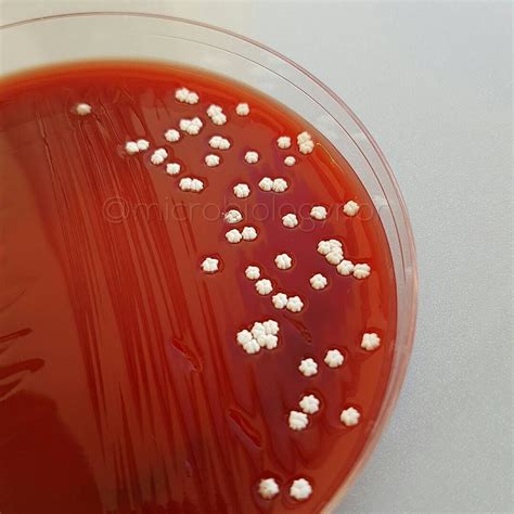 Nocardia Brasiliensis Here Seen On Blood Agar 4 Days Old Nocardia