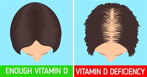 6 Warning Signs That You Are Lacking Vitamin D Bright Side