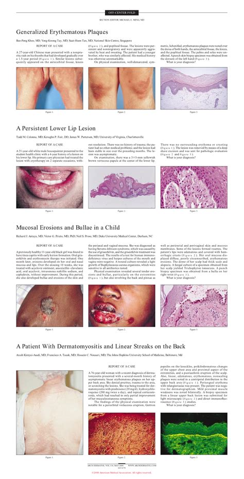Mucosal Erosions And Bullae In A Child Dermatology Jama Dermatology