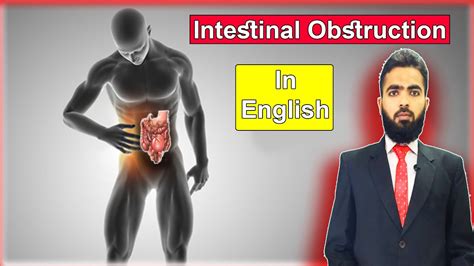 Intestinal Obstruction Causes Symptoms Diagnosis Treatment