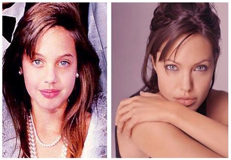 Angelina Jolie Before After Angelina Jolie Plastic Surgery Plastic Surgery Celebrity Plastic