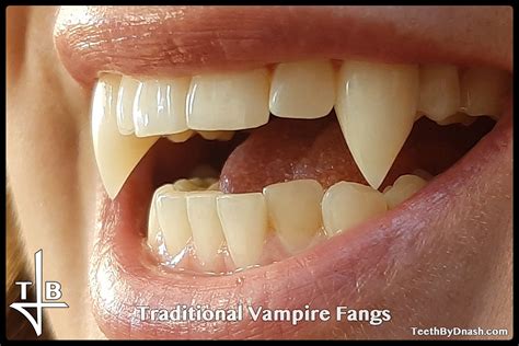 Traditional Vampire Teeth By Dnash