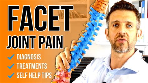 Facet Joint Back Pain Exercises Treatment And Other Must See Top
