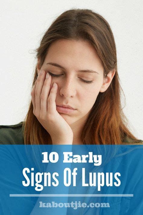 10 Early Signs Of Lupus Kaboutjie Lupus Lupus Facts Lupus Symptoms