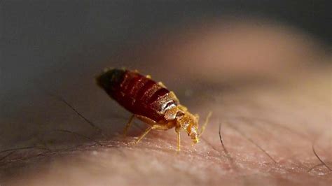Whats It Like To Be Bitten By A Bedbug