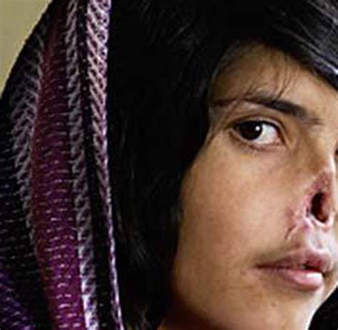 Bibi Aisha Afghanin Von Time Titel Wird Operiert Welt