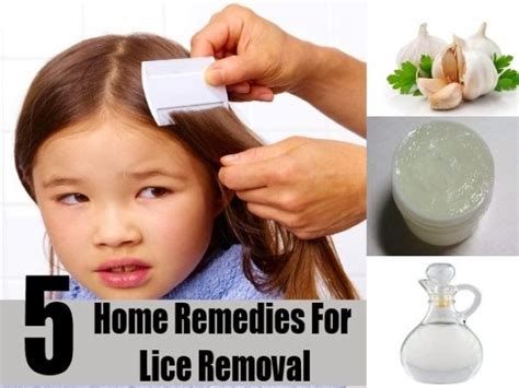 Home Remedies For Lice Removal