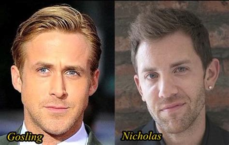 Ryan Gosling Plastic Surgery Before And After Nose Job Plastic Surgery Hits