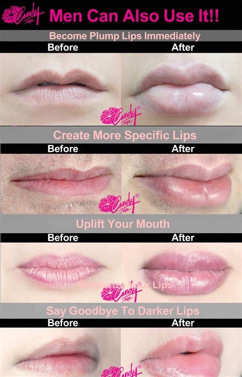 How To Plump Lips With 11 Non Invasive Methods Diy Lip Plumper Lip Plumper Device Lips Fuller
