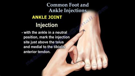 Common Foot And Ankle Injections Everything You Need To Know Dr