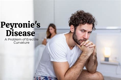 What Is Peyronie S Disease Problem Of Erectile Curvature Dr Irfan Shaikh Urolife Clinic Pune
