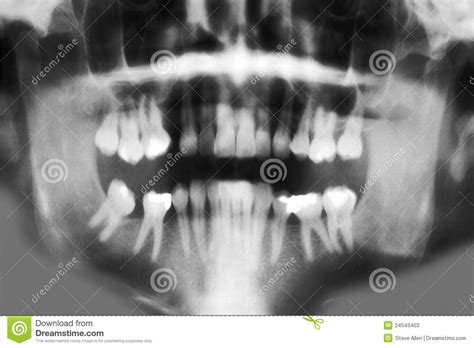 Dental X Ray Full Mouth Scan Stock Photos Image 24543403