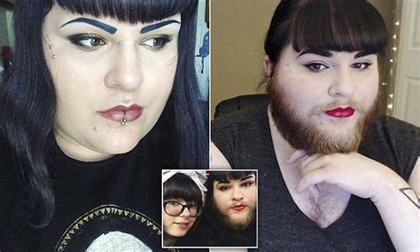 Woman With Pcos Grows A Full Beard After Finding Love