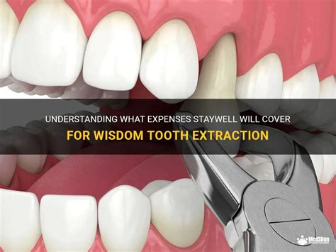 Understanding What Expenses Staywell Will Cover For Wisdom Tooth