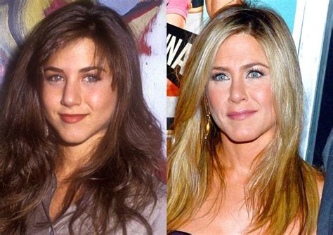 Did Jennifer Aniston Get Plastic Surgery Including Nose Job And Botox