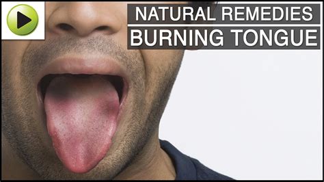 This can disrupt the ability of the microvilli to accurately detect what it is tasting or sensing. Burning Tongue - Natural Ayurvedic Home Remedies - YouTube