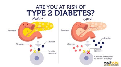 دیابت نوع 2 چیست و چطور می توان از آن پیشگیری کرد جهان شیمی فیزیک