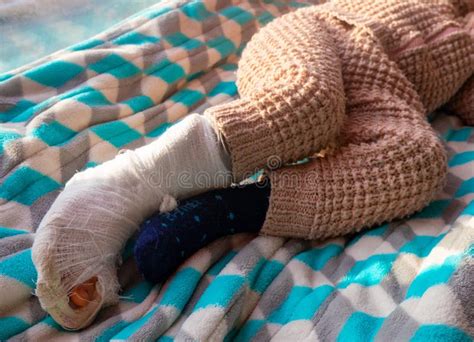 Child Boy With Bandage On Leg And Lying Down Hospital Bed Stock Photo