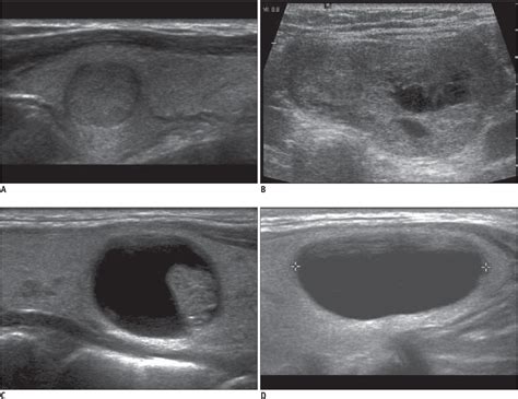 Figure 1 From Ultrasonography And The Ultrasound Based Management Of