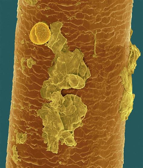Dead Skin Cells Under Microscope Micropedia