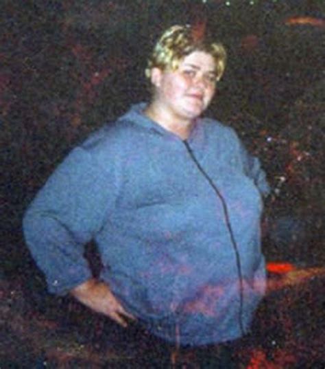 Desperate Sabrina Edwards Took Out £9k Loan For Gastric Band Op After Nhs Refused Surgery