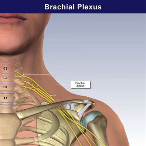 Brachial Plexus Trialexhibits Inc