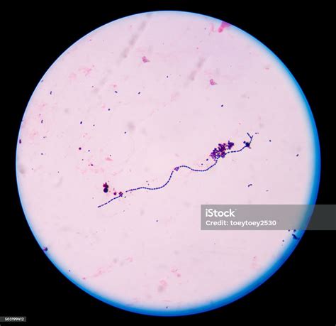 Gram Positive Cocci In Chain Stock Photo Download Image Now