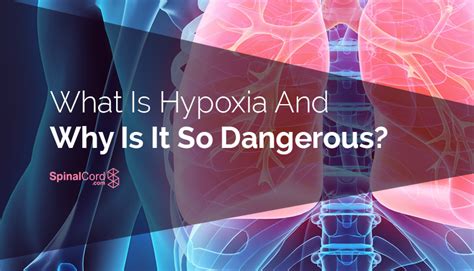 Hypoxia Definition Causes Symptoms And Treatment