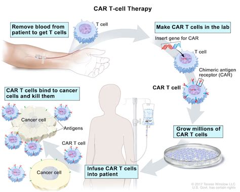 Car T Cell Therapy For Cancer Ohsu