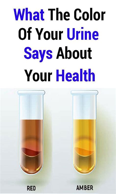 What The Color Of Your Urine Says About Your Health Weightlossplan