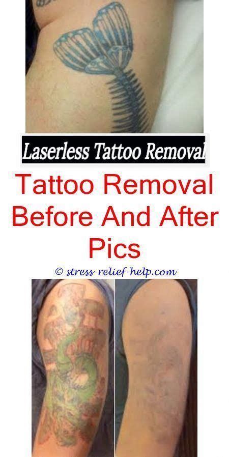 It only affects the external surface of the skin, without they can cause your skin to reject the laser, causing various skin reactions. Can i get a tattoo removed while pregnant.Colorful tattoo ...