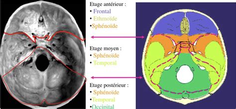 Limite étage Antérieur Et Moyen De La Base Du Crâne Ue10 Tête Et