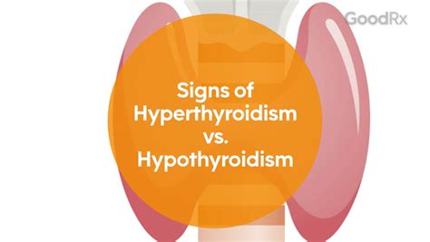 Signs Of Hyperthyroidism Vs Hypothyroidism How To Tell The Difference