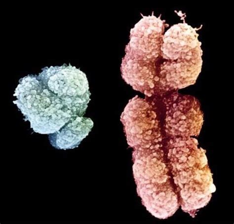 Cromosomas Humanos X E Y Vistos Al Microscopio Sem Y Coloreados Imagen De Biophoto Associates