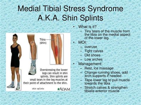 Shin Splints Medial Tibial Stress Syndrome
