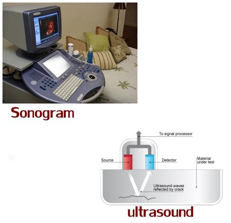 Ultrasound Vs Sonogram New Health Advisor