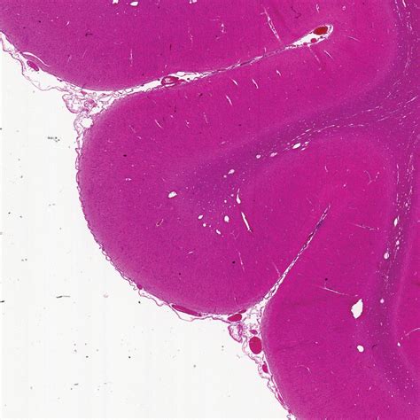 Mammal Cerebrum Sec 7 µm Hande Microscope Slide Carolina Biological