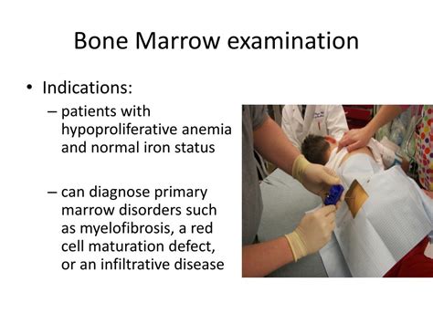 Ppt Anemia Powerpoint Presentation Free Download Id1934338