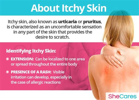 Dry And Itchy Skin Shecares