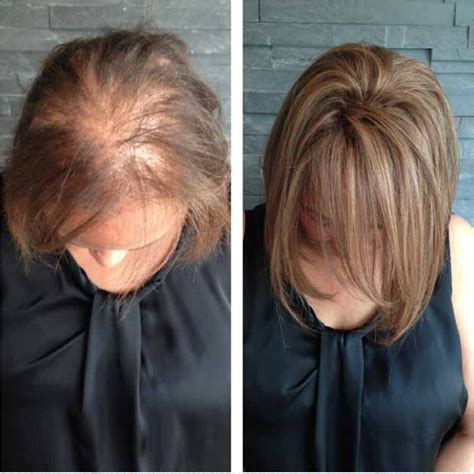 Thin Hair Solutions Hairstyles For Thin Hair Extensions For Thin Hair