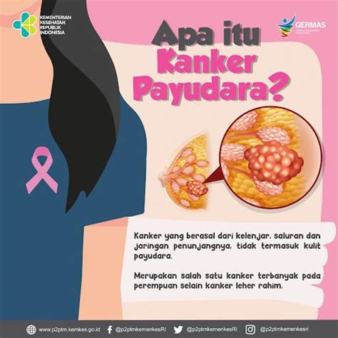 Proteksi Kanker Payudara Dan Dan Tindakan Preventifnya Mamak Pintar