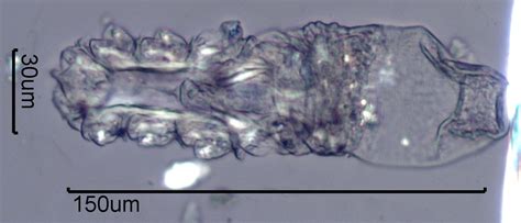 25 New Demodex Mites Under Microscope Demodectic Mange