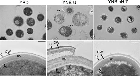 Frontiers Cell Wall Composition In Cryptococcus Neoformans Is Media