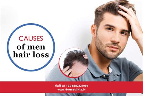 the most common reasons for male hair loss in 2023