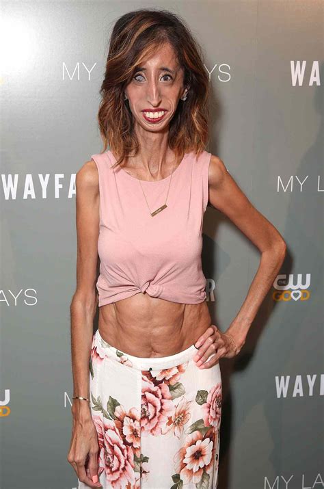 Lizzie Velasquez Responds To Unwillingly Becoming Face Of A Body Shaming Meme